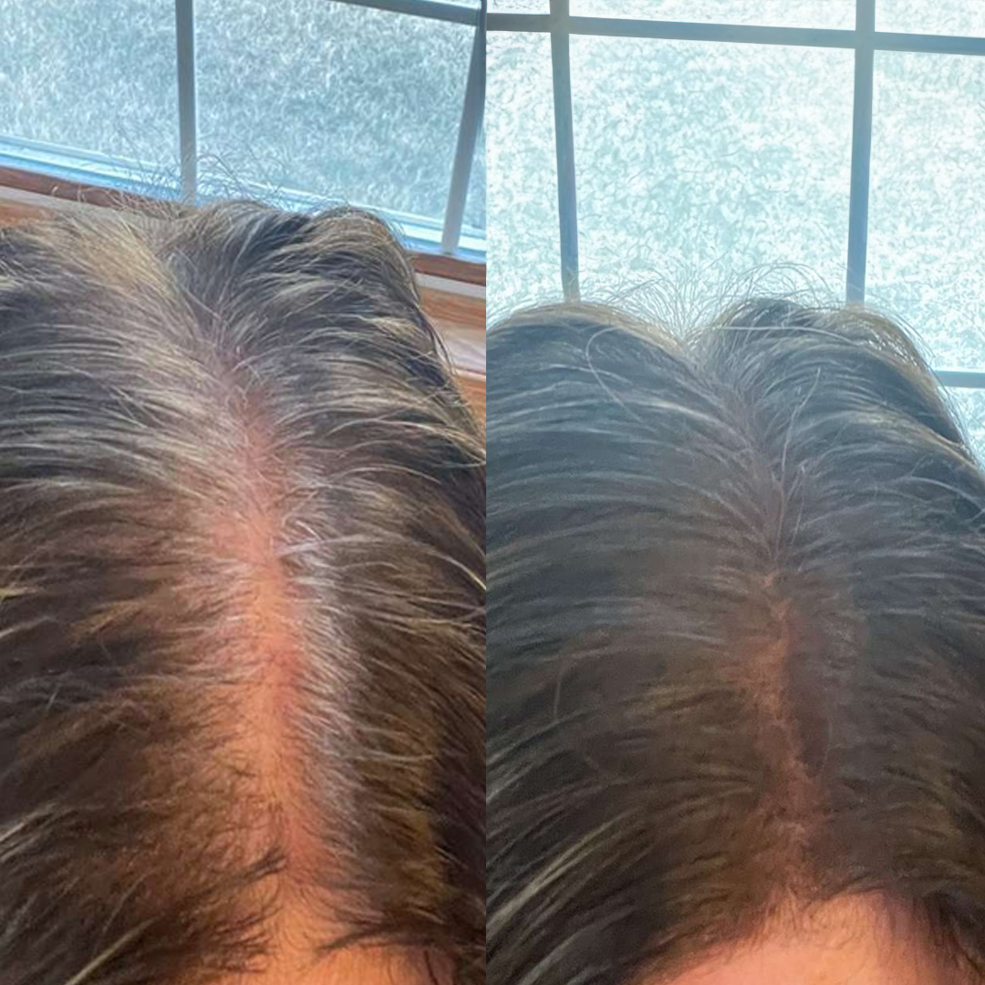 gray hair testi2.png__PID:730c0323-d013-4a5c-9f54-6bb11976440c